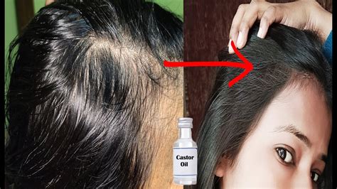 Best Castor Oil For Hair Regrowth Use Of Castor Oil For
