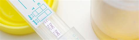 urine testing urine testing company