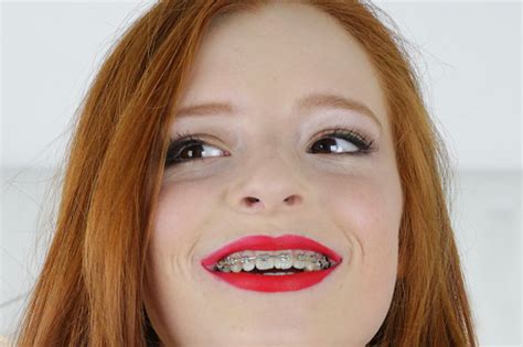Closeup Image Of Red Haired Teenage Girl 14 15 With Pale Skin And
