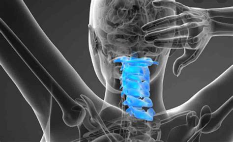 Cervical Spinal Fusion Fort Worth Brain And Spine Institute