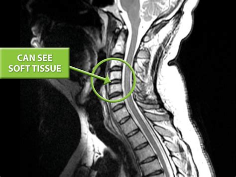 Imaging The Neck And Back Clinics