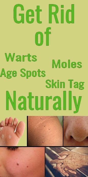 how to get rid of warts moles age spots and skin tag