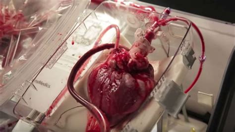 impresionante video muestra un corazón latiendo fuera del cuerpo la red