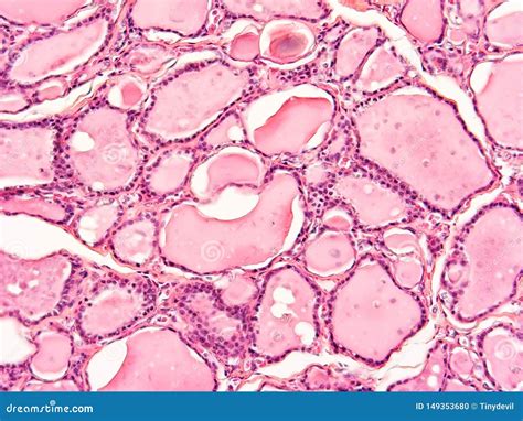 histology  human thyroid gland tissue stock photo image