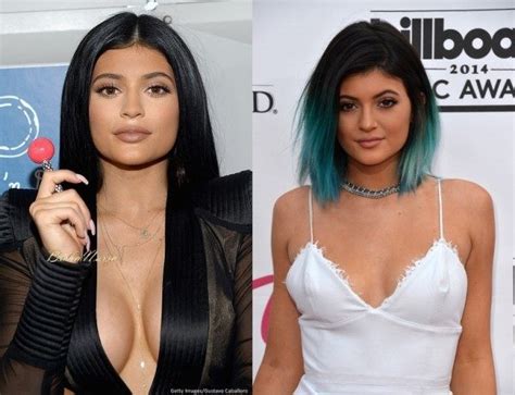 Kylie Jenner Denies Rumors That She Got Breast Implants