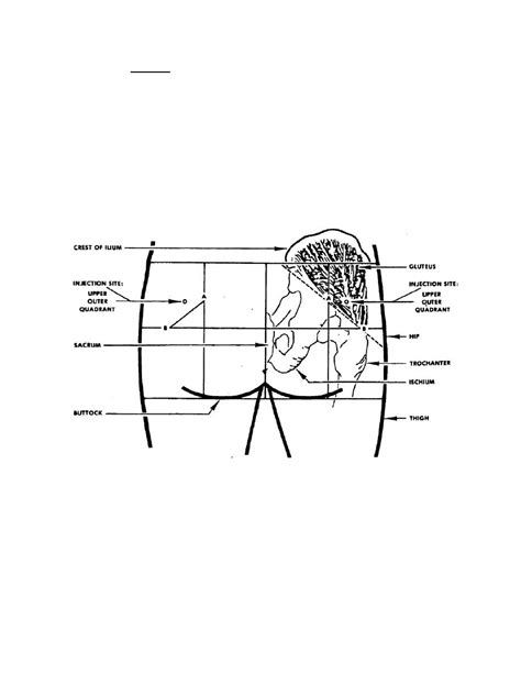 Figure 2 1 Intramuscular Injection Site In The Buttocks Upper Outer