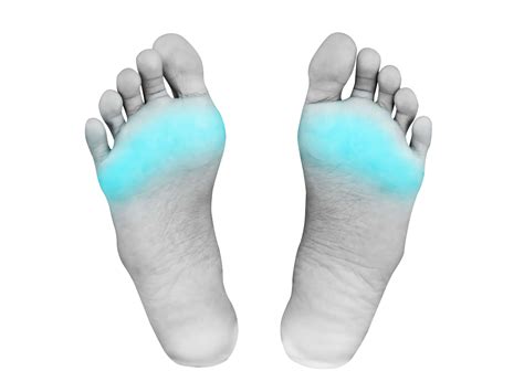 metatarsalgia ball  foot pain ace podiatry