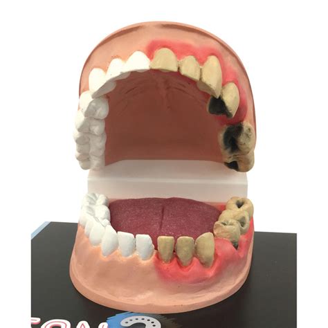 clean dirty mouth dental health display health edco