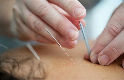 acupuncture may lower stroke risk in people with