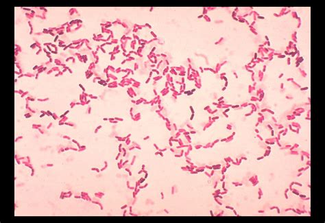 Public Domain Picture Bacillus Firmus Gram Stain Id
