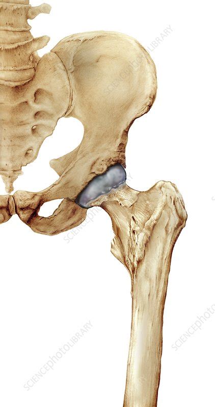 Hip Bones Artwork Stock Image C016 7015 Science