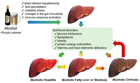 nutrients free full text nutritional support for alcoholic liver