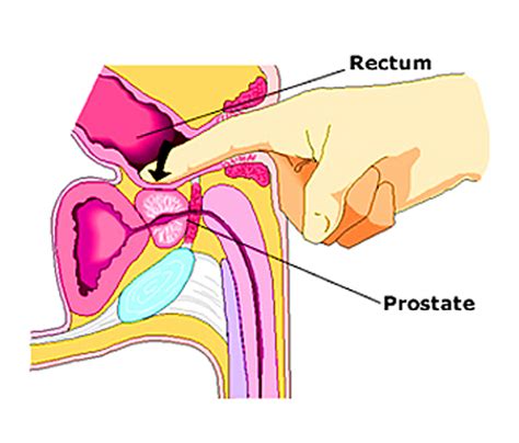 the prostate massage therapist do you really need professional assistance