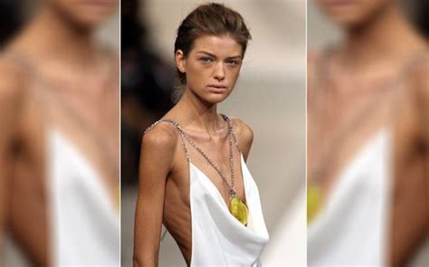 French Law Banning Extra Skinny Models Is Leading To A Big Debate