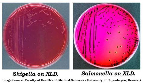 shigella  salmonella colonies  xld  medical technology