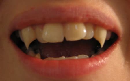real fangs   dentist vampirescom