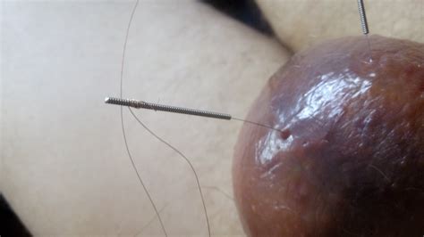amateur pussy needles