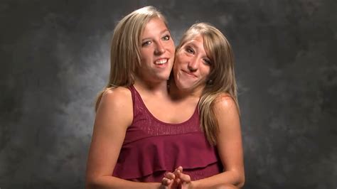 abby and brittany hensel conjoined twins where are they now cupuno