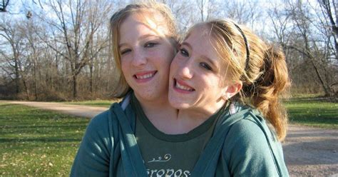 9 Facts About Abby And Brittany That Show There S More To Them Than