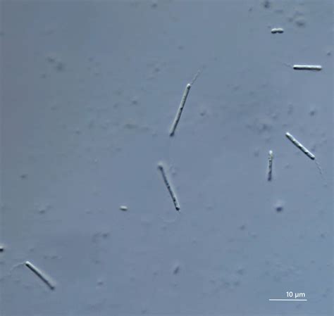 bakteriengeisseln im lichtmikroskop