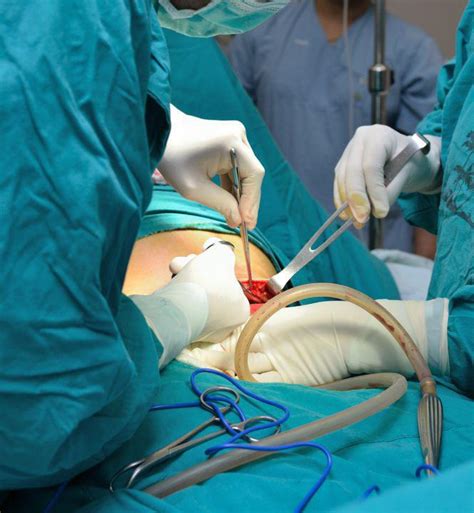 open abdominal surgery for extensive multisystem conditions newport