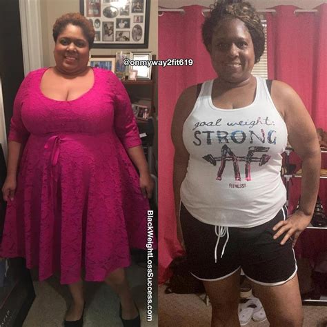 Pin On Before And After Weight Loss Stories