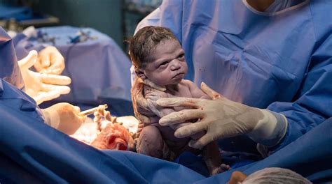 newborn   epic face   birth photo   viral