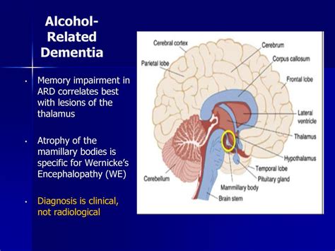 complex relationship  alcohol dementia vistasol medical group