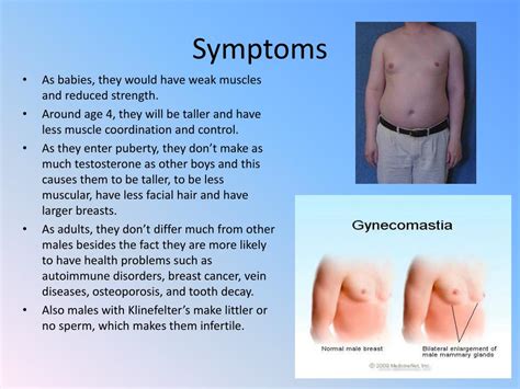 Ppt Klinefelters Syndrome Powerpoint Presentation Free Download