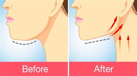get rid of double chins with this exercise and natural treatment youtube