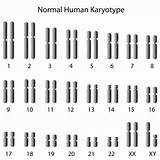 Gene Expression Karyotype Disorders Human Epigenetics Chromosomal Study sketch template