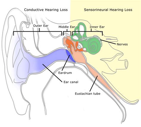 hearing loss tinnitus  imbalancevertigo