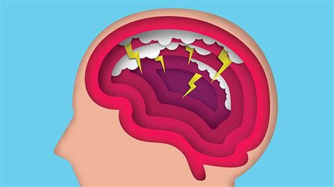 Why Chronic Migraine Goes Undiagnosed Everyday Health