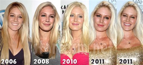 photos heidi montag how is her face holding up after those 12 plastic surgeries