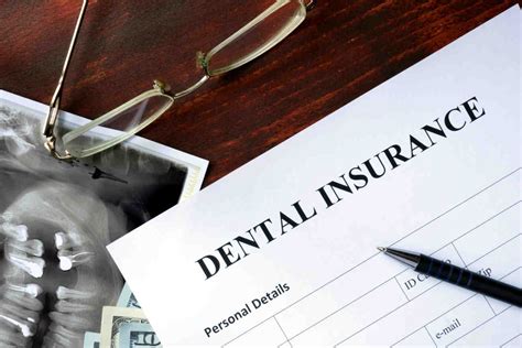 health insurance cover dental implants dental news network