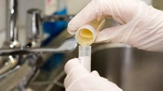 urine test  cjd  possibility bbc news