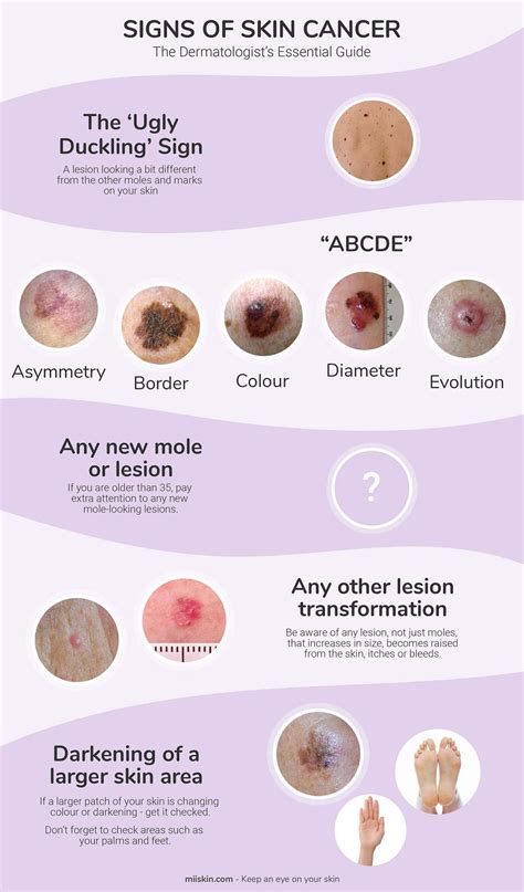skin cancer signs symptoms  dermatologists essential guide