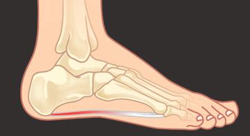 big toe joint arthritis feet specialists  foot pod