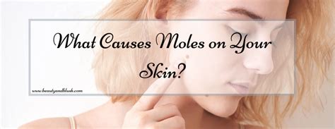 what causes moles on your skin beauty and blush