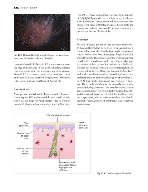 Medicine By Sfakianakis G Alexandros Skin Disease In Perspective 4