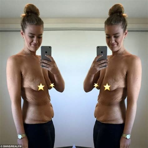 this woman agonised about revealing these images 70k people believe she made the right