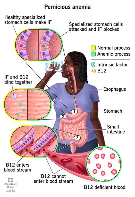 vitamin  deficiency symptoms tongue