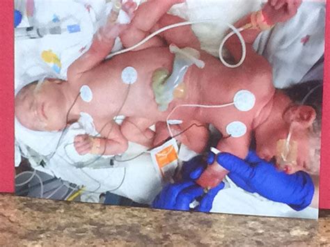 Photos Identical Triplets Born In Texas Hospital Includes