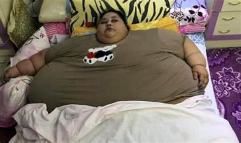 The World S Fattest Woman Who Once Weighed 79 Stone
