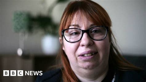 bell s palsy i woke and the night had stolen my smile bbc news