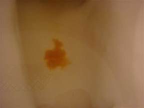 Pooping blood and painful sex