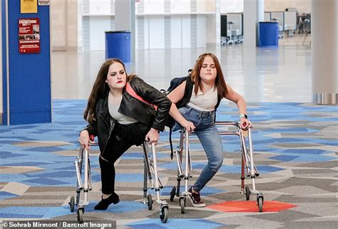 utah twins who have one leg each say they feel the same as everybody