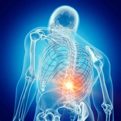 spinal arthritis treatment  pemf  reduce  pain levels