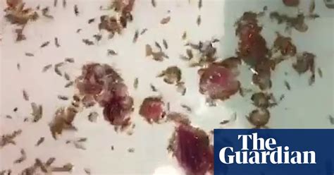 Sea Lice Feast On Fresh Meat In Australia After Teenager Left