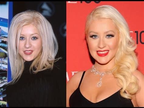 hollywood actresses     plastic surgery shocking